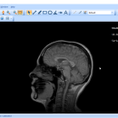 Portable MicroDicom freeware screenshot